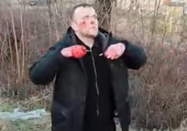 Суд арештував водія, який перебуваючи під наркотиками, виїхав на тротуар і збив трьох людей на Львівщині. Скріншот із відео.