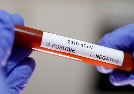 Чому матеріал на діагностику коронавірусу відправляють у Київ, якщо у Львові є тести. Фото: DW