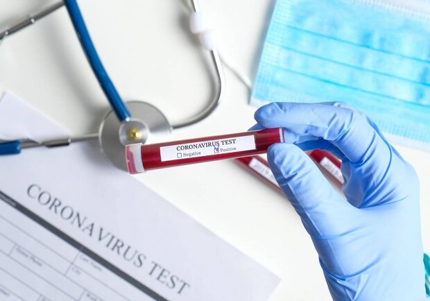Уже семеро: на Львівщині зафіксували нові випадки коронавірусу фото