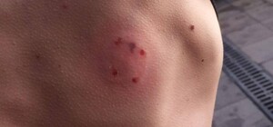 На одеському Привозі наркоман-вампір покусав людей до крові