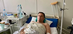 Столичні лікарі врятували чоловіка з Бучі, родину якого розстріляли путінські солдати