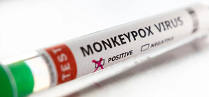 Чи дійде вірус мавп'ячої віспи до України: відповідь МОЗ