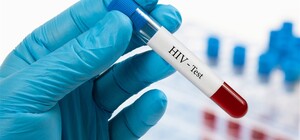 В Україні запустили чат-бот, що допоможе оцінити ризик захворіти на ВІЛ