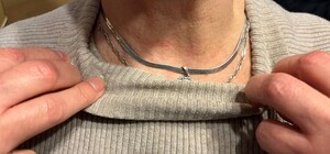 У Дарницькому районі жінку в хостелі пограбували та душили до втрати свідомості