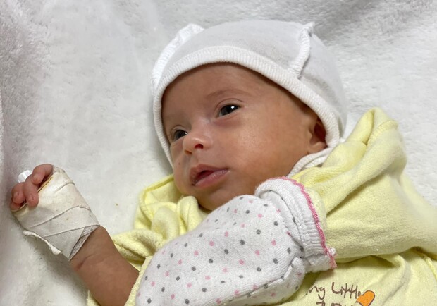 Львівські лікарі сформували кишківник новонародженій дитині 
