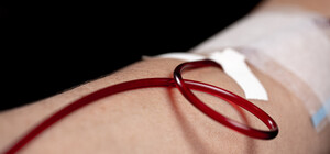 Віддав свою нирку: харків'янку врятував від смерті власний чоловік