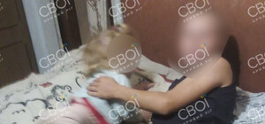 У Дніпропетровській області в руках у дитини вибухнула батарейка 