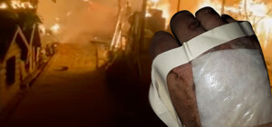 У Запоріжжі підпалили притулок на Бабурці: собаки згоріли заживо