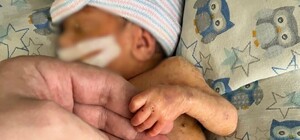 В Одеській області врятували малюка, який народився на 29-му тижні