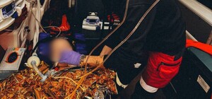 У Дніпрі рятують чотирьох дітей після атаки у Кривому Розі: їх стан