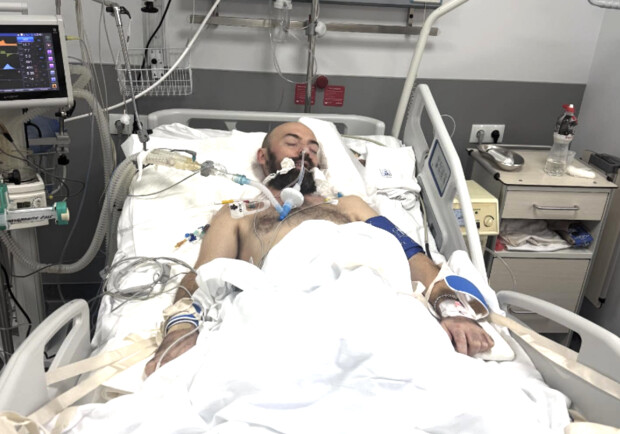 Співак Adam у комі: Міша Клименко бореться з туберкульозним менінгітом -