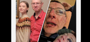 Жорстоке затримання у парку Києва: батько отримав перелом очниці та крововилив у мозок