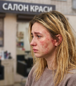 Зіпсували волосся або спалили шкіру в салоні: адвокат пояснила, як отримати компенсацію