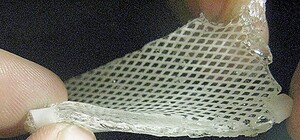 Винахід львівських вчених допоможе врятувати життя тисяч солдат з АТО