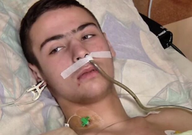 Новина - Події - У Львові 17 річному хлопцю ставили діагноз "гастрит", а потім видалили весь кишківник (відео)