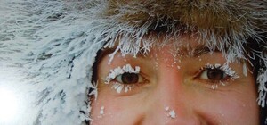 Жертва холоду чи алкоголю: 30-річну львів'янку госпіталізували з обмороженням