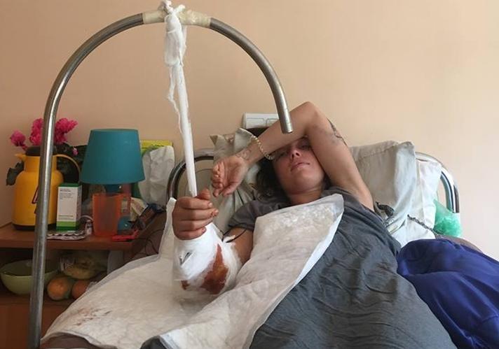Львів’янка Катерина Бридун, на яку на базі відпочинку напав ведмідь, вже перенесла дві операції.