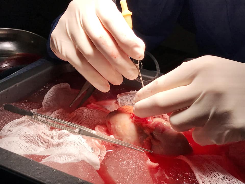 Мінімум розрізів: у Львові провели унікальну операцію. Фото: Львівська міськрада