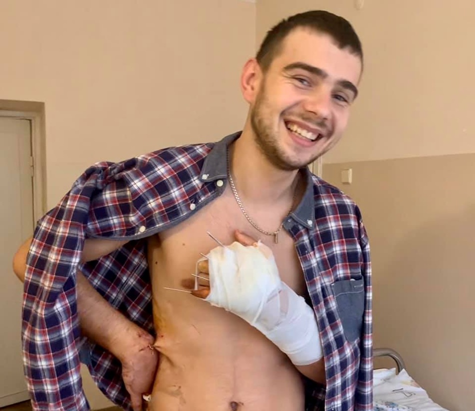 У Львові лікарі врятували від ампутації руку 23-річному хлопцеві. Фото: Львівська міськрада 