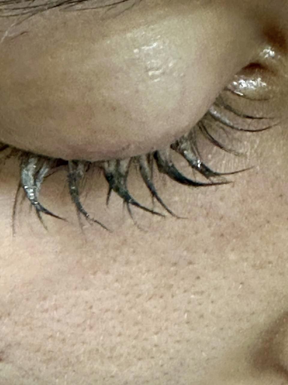 17-річна дівчина з Львівщини втратила вії після нарощення штучних.