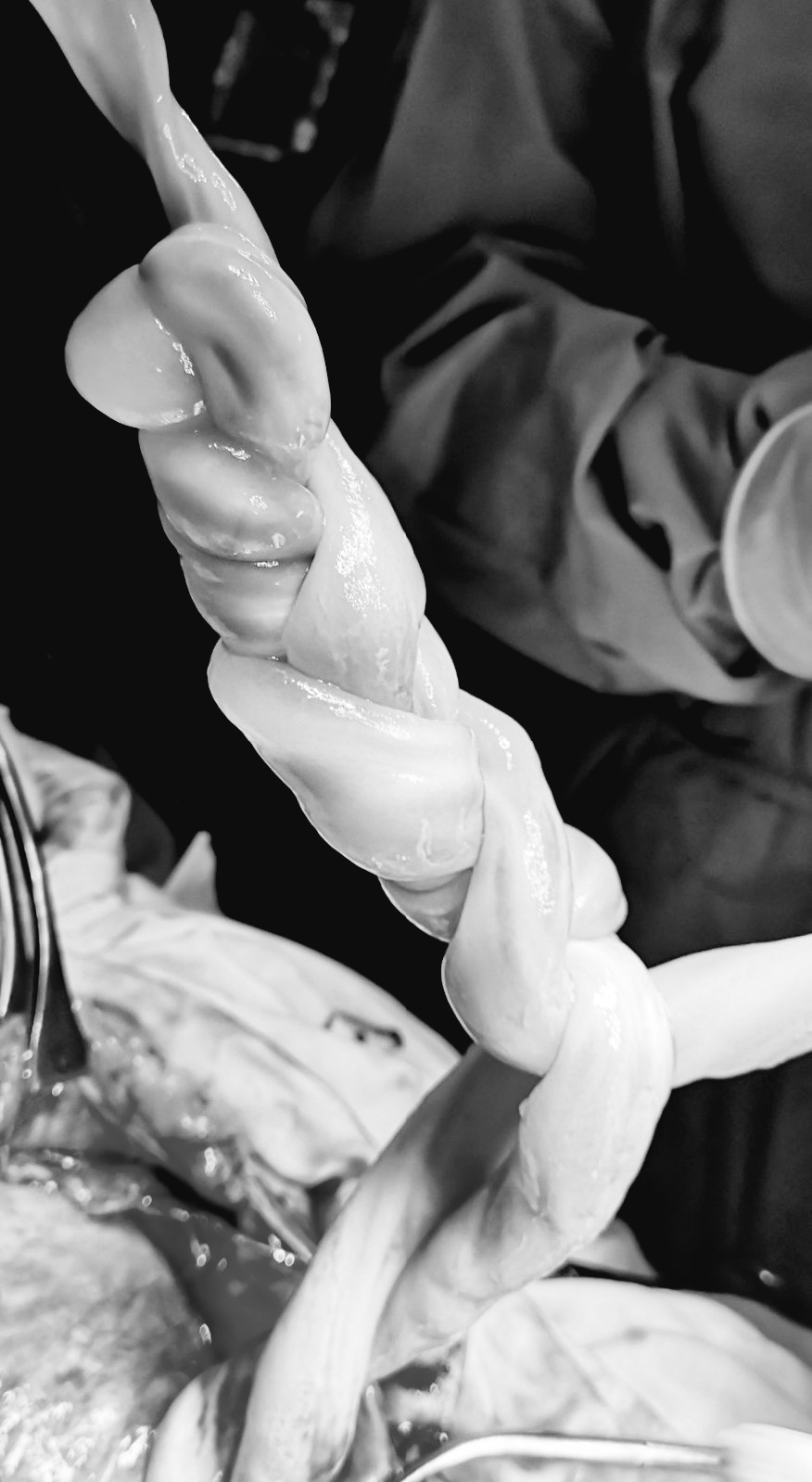 У Львові народилися унікальні близнюки – фото.