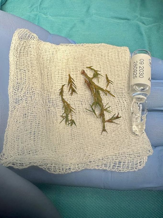 На Львівщині дитина ледь не задихнулася гілочками ялинки.