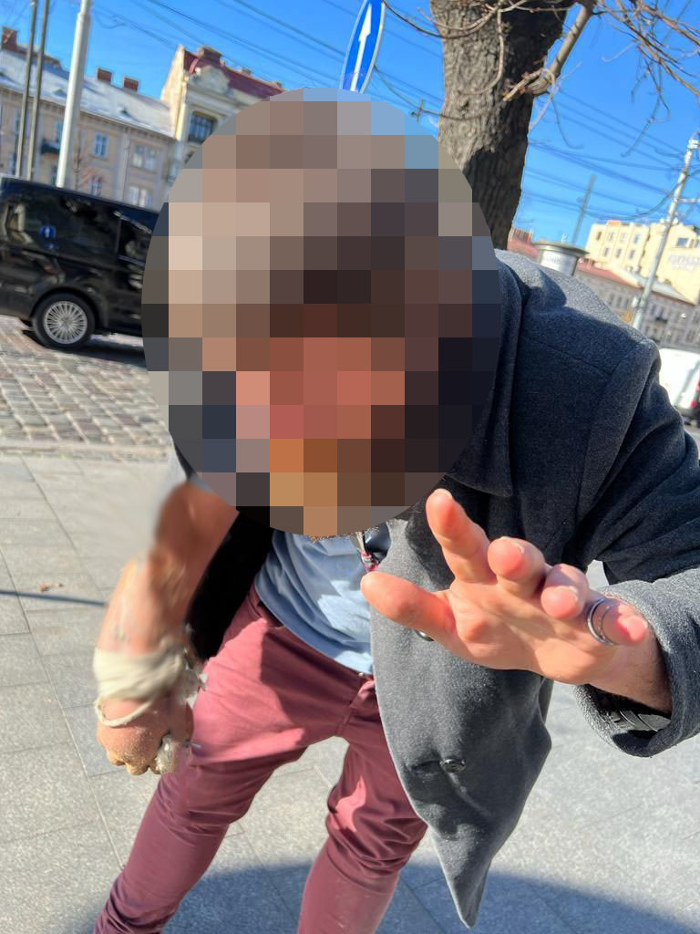 Поліцейські затримали 33-річного чоловіка з Луганщини, який на вулиці Степана Бандери спалив автомобіль львів'янину.
