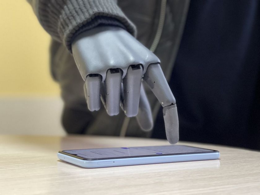 У Львові бойовому медику встановили біонічну руку, за тиждень він повернеться на передову.