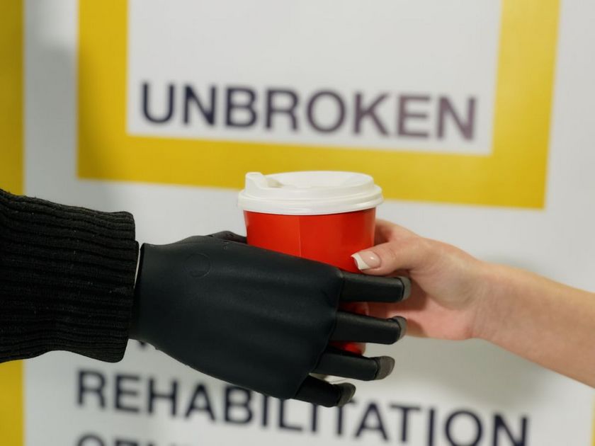 У Львові бойовому медику встановили біонічну руку, за тиждень він повернеться на передову.