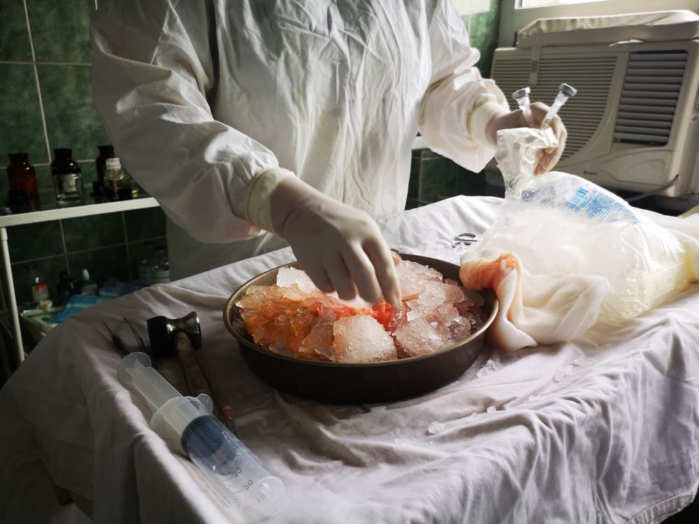 Львівські лікарі вперше провели операцію з пересадки серця та двох нирок. Фото: Львівська міськрада.