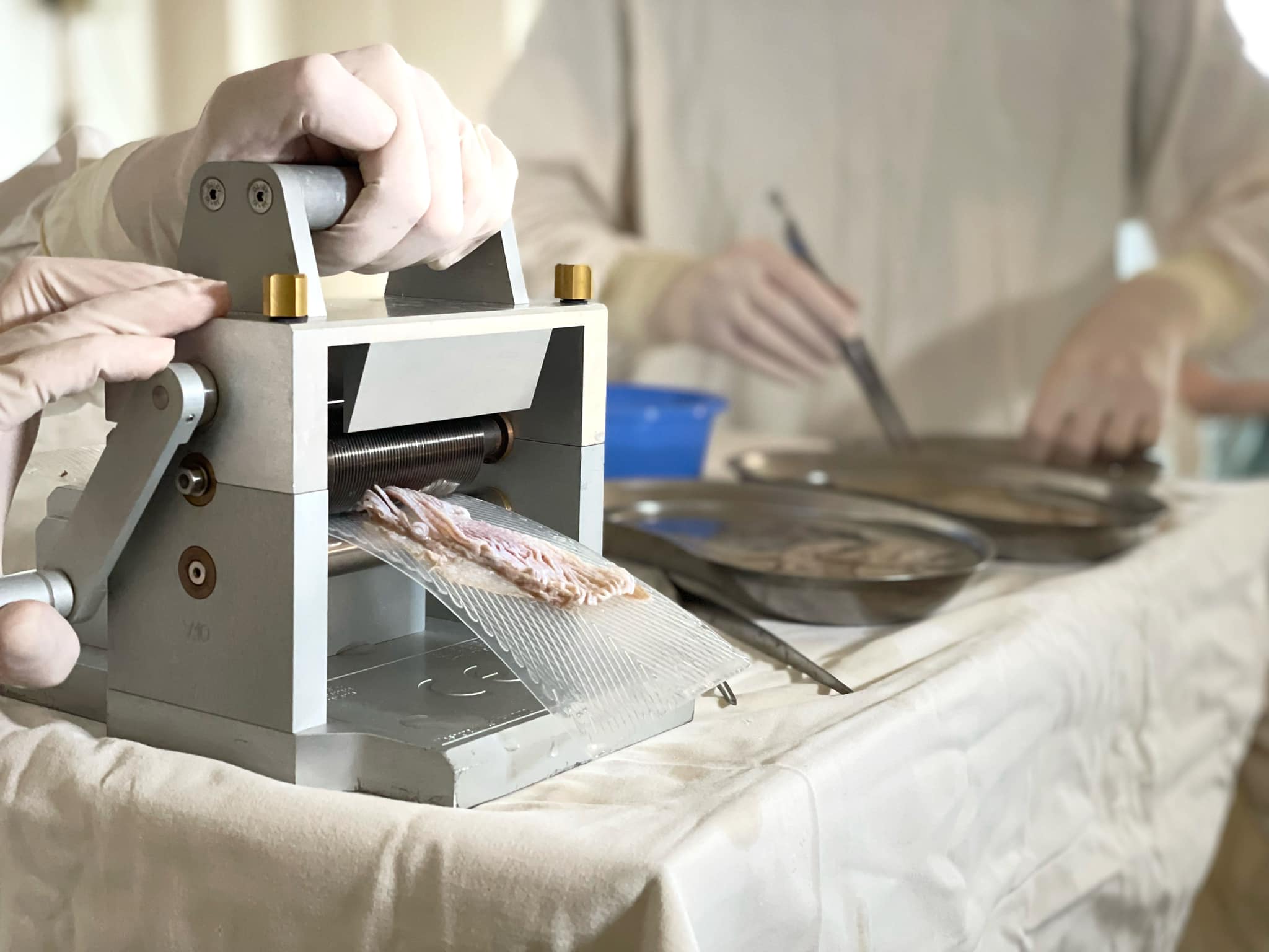 Вперше в Україні: у Львові дитині пересадили шкіру від посмертного донора.