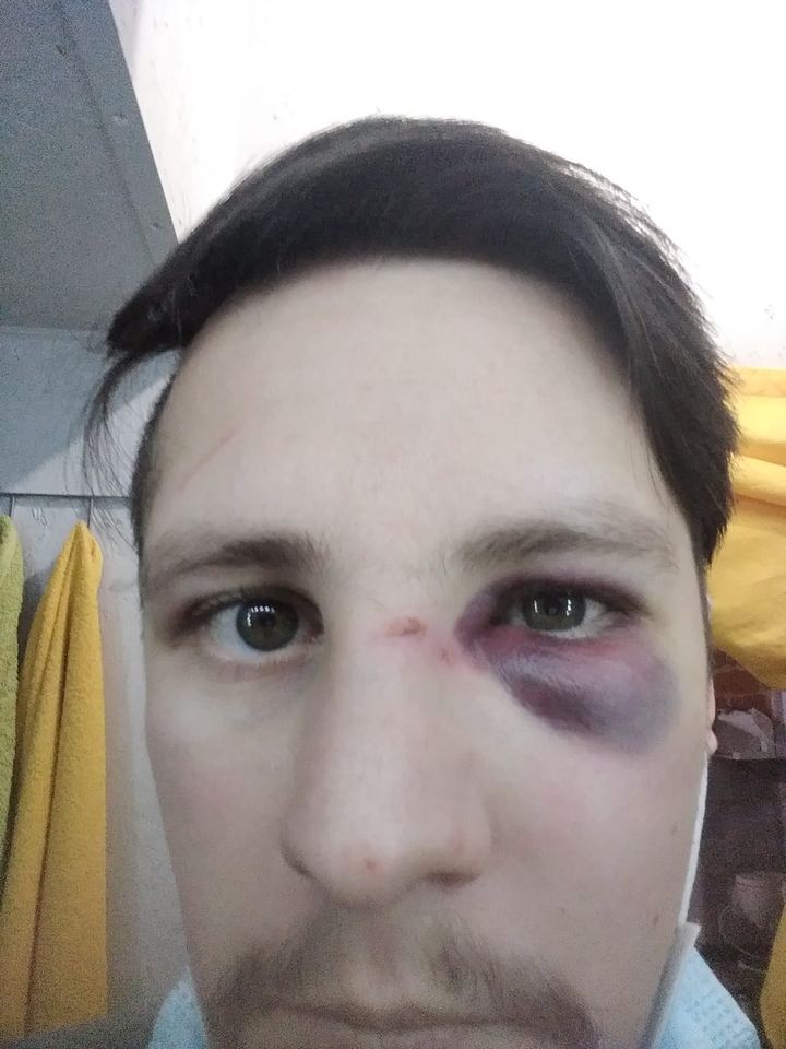 Двоє львів'ян заявили, що у центрі Львова на них напали поліцейські. Фото: Андрій Мочурад 