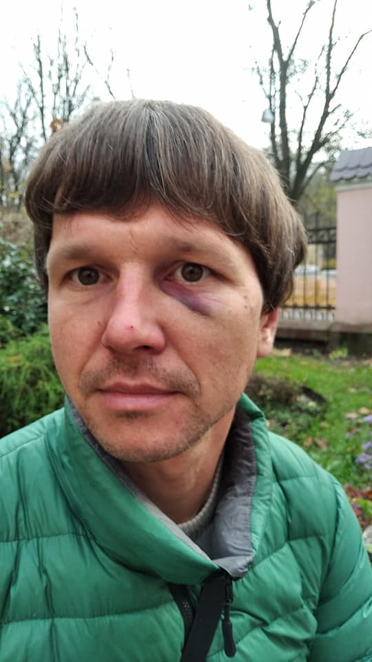 Двоє львів'ян заявили, що у центрі Львова на них напали поліцейські. Фото: Андрій Мочурад 