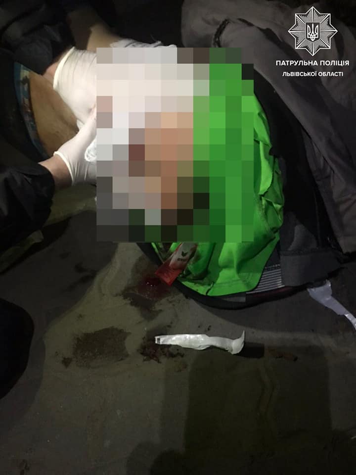 У Винниках підрізали чоловіка. Фото поліції