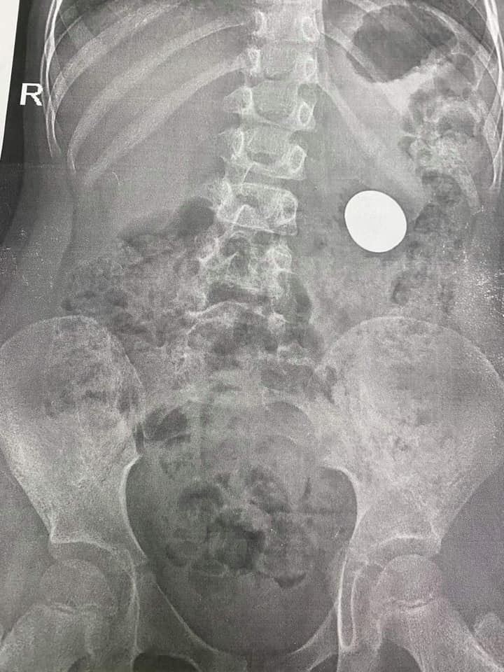 Фото: лікарня ОХМАТДИТ