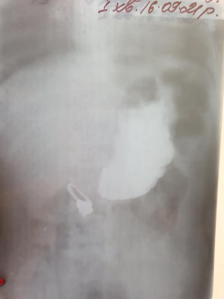 Фото: ОХМАТДИТ