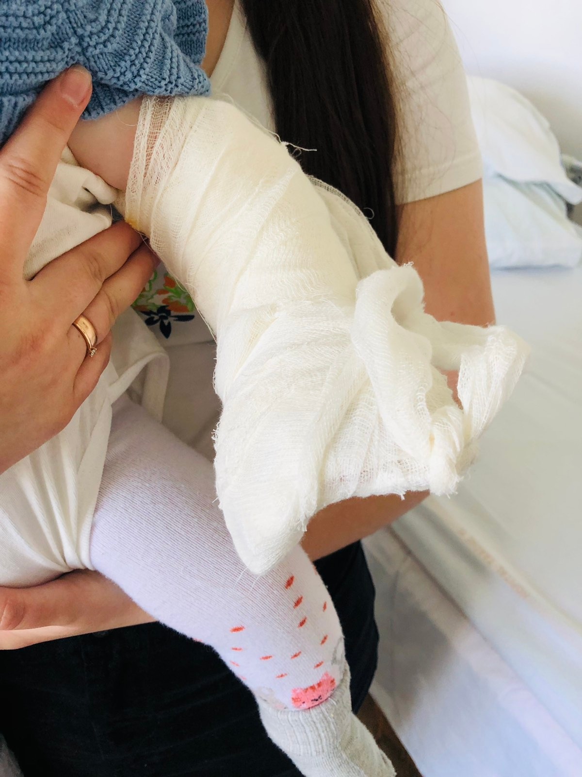 Львівські лікарі видалили 8-місячній дитині зайвий пальчик