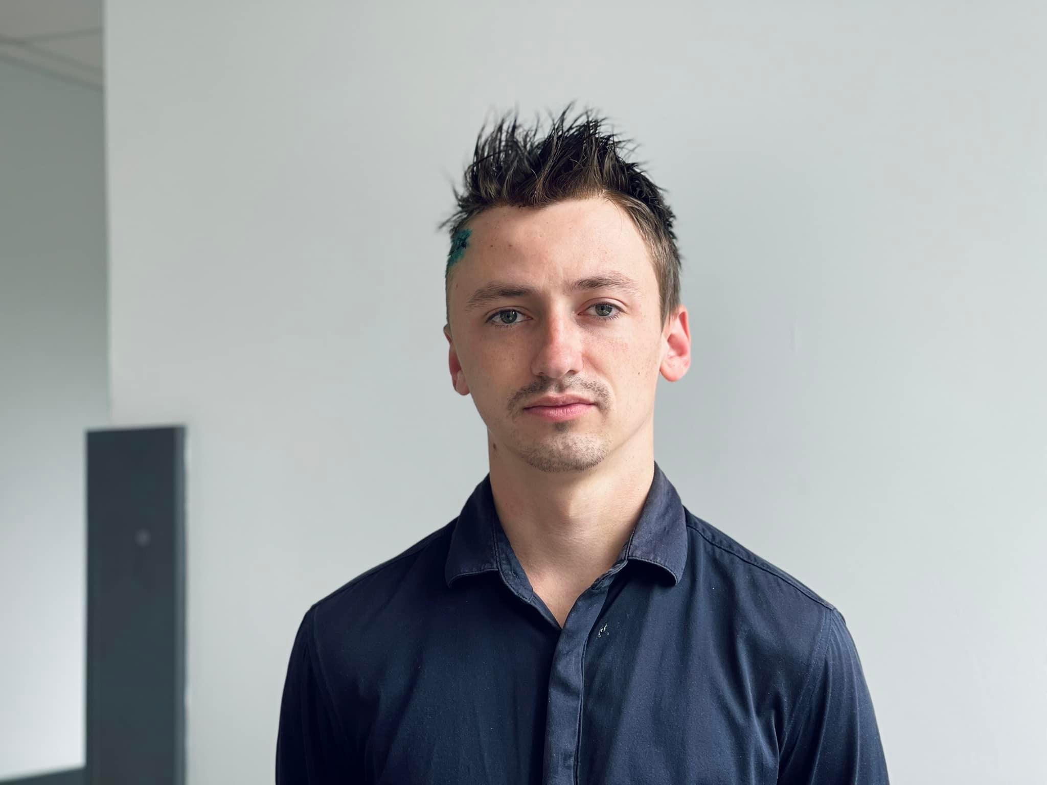 Львівські лікарі врятували хлопця, який 13 років страждав від нападів епілепсії