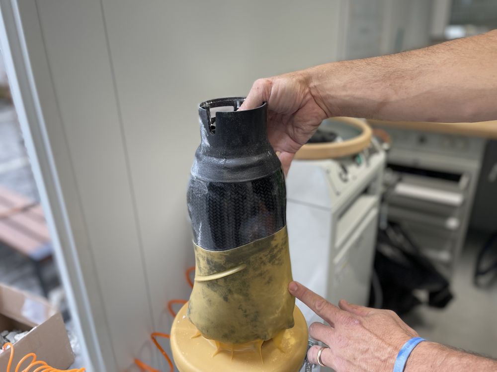 У львівській лікарні виготовили і встановили протез за чотири години