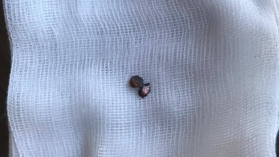 Народився в сорочці: медики розповіли про стан пораненого охоронця львівсього ярмарку. Фото: Львівська лікарня швидкої допомоги