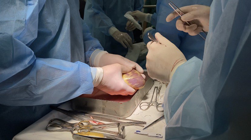 У Львові здійснили уже четверту пересадку серця. Фото міськради