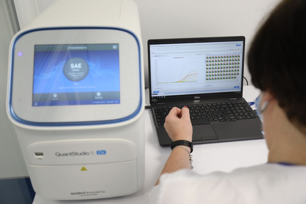 У лікарні швидкої допомоги Львова запрацювала надсучасна лабораторія. Фото міськради