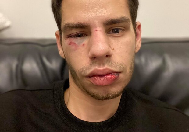 У Львові водій таксі Bolt напав на пасажира. Фото: Айтал Сергєєв