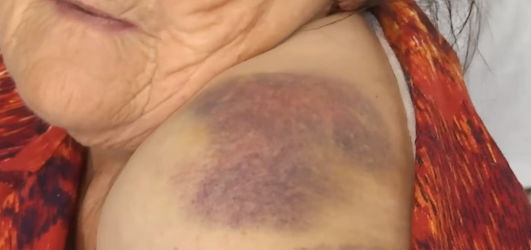 На Львівщині староста села побив пенсіонерку. Фото: скріншот з відео ТСН