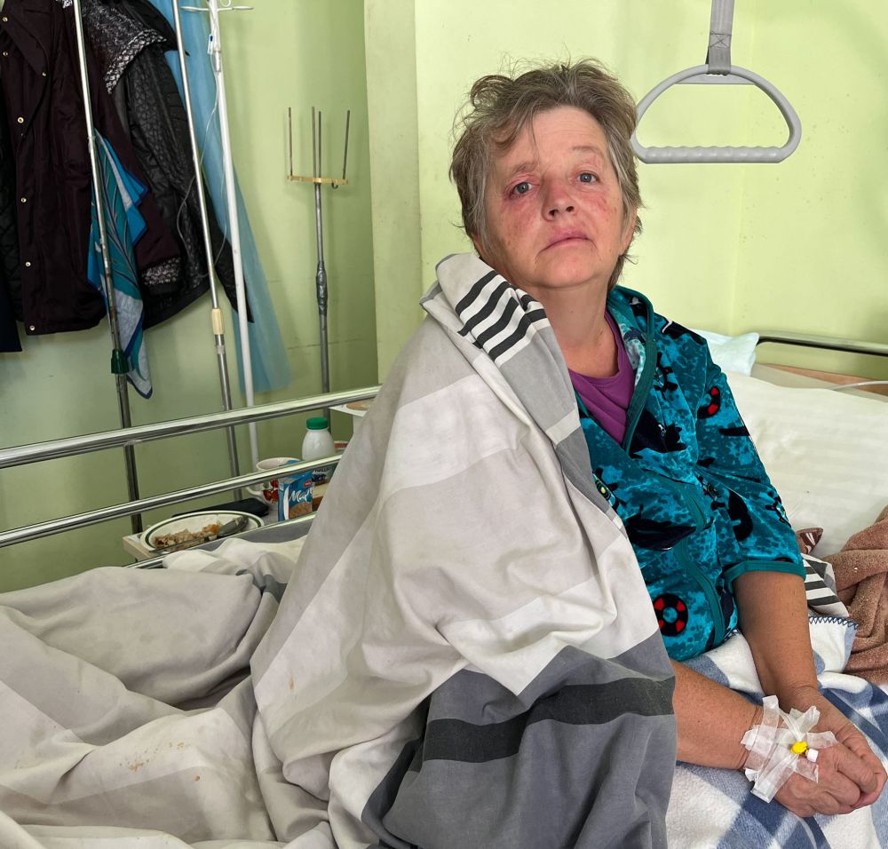 У львівській лікарні прооперували жінку з великою аневризмою мозкової артерії