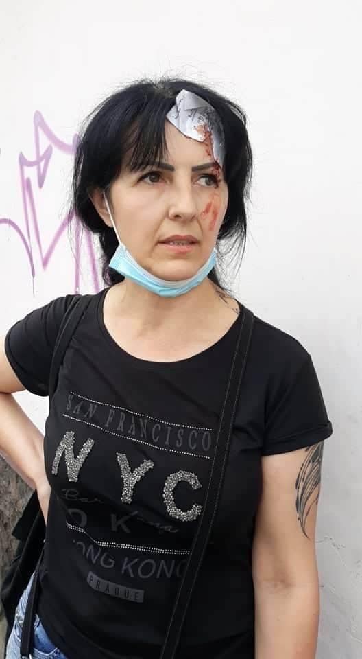 Постраждала Ірина Командор. Фото: Варта-1