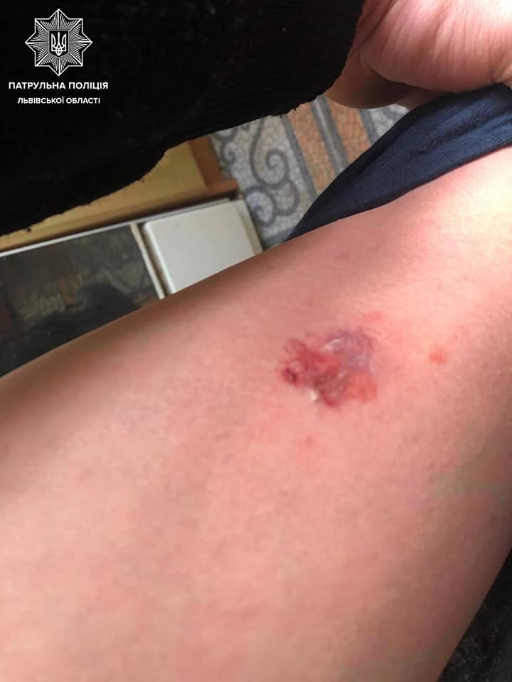 Львів'янин покусав патрульного. Фото поліції