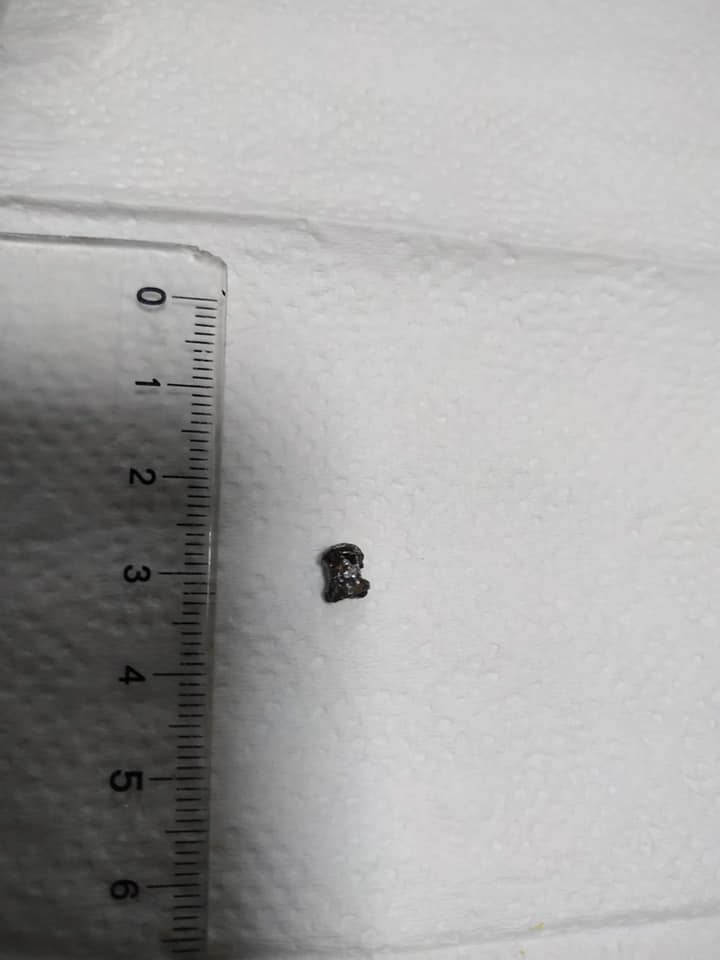 Львівські лікарі прооперували 6-річного хлопчика. Фото ОХМАТДИТу