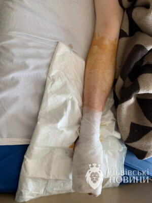 В центрі Львова на студентку впали брили льоду. Фото: Львівські новини