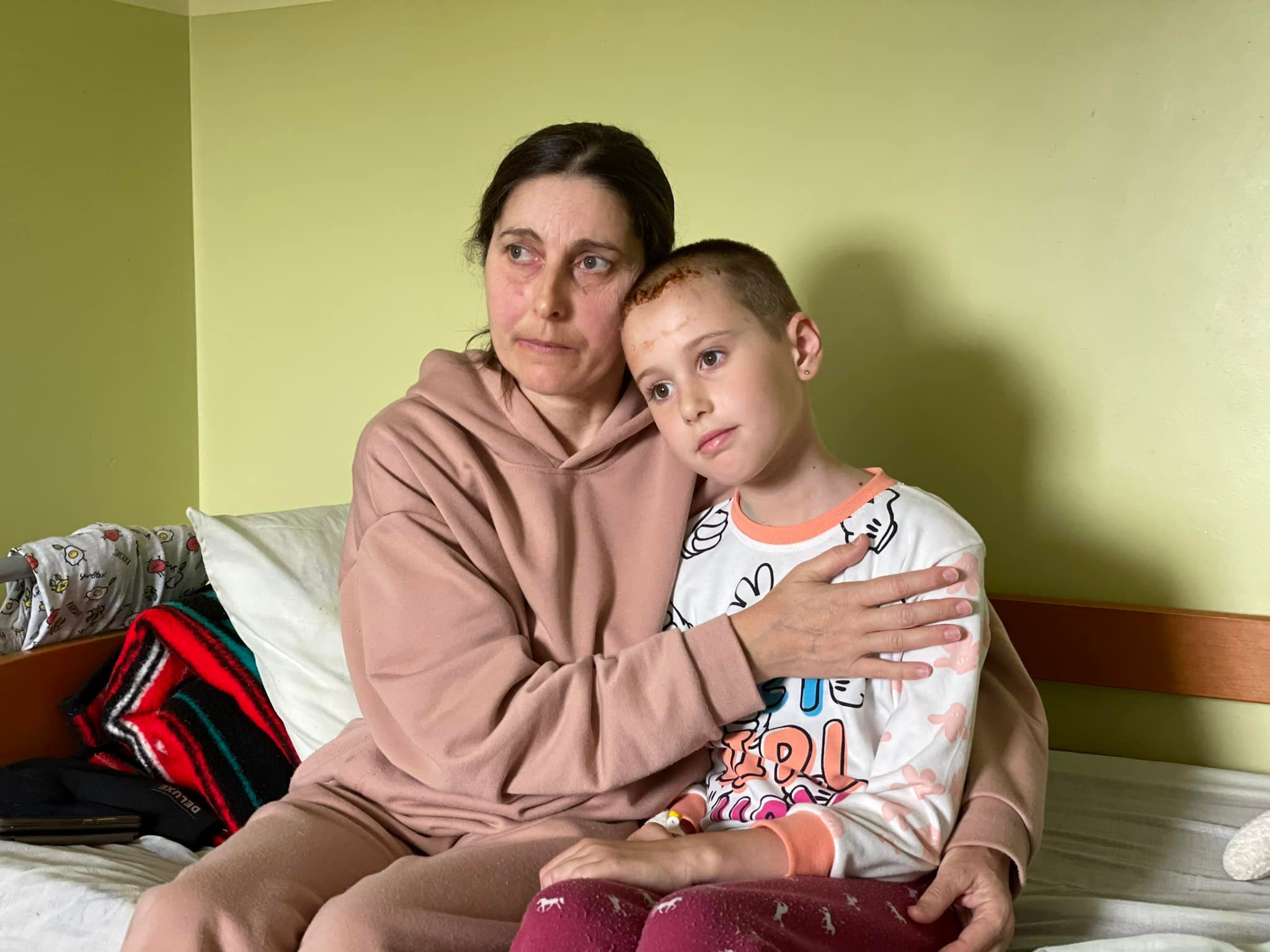 У львівській лікарні врятували 9-річну Софійку, якій крізь мозок пройшов уламок касетного снаряду